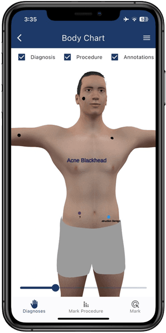 Interactive 3D Body Chart