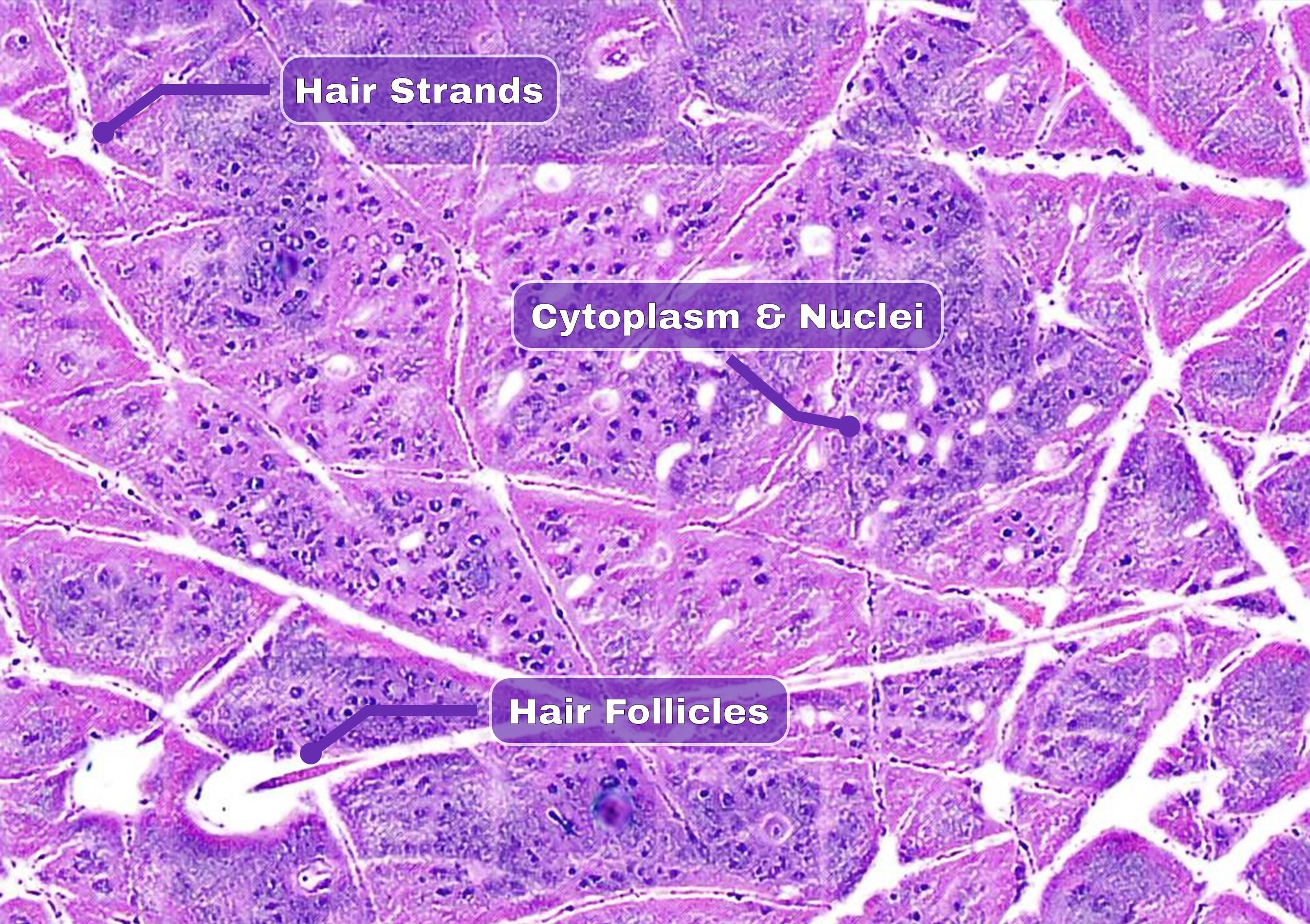 Enhanced Visualization of Skin Tissue