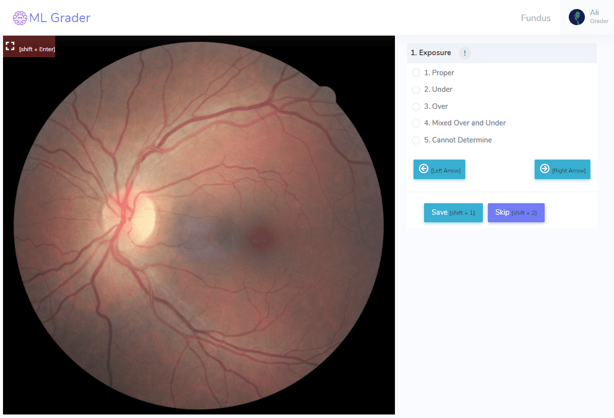 One Application for <br />Everything Fundus