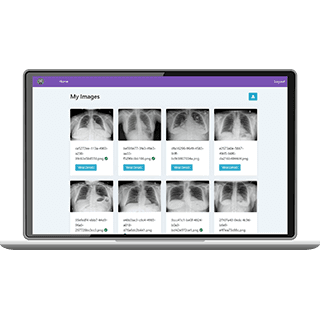 CXR Report Generator
