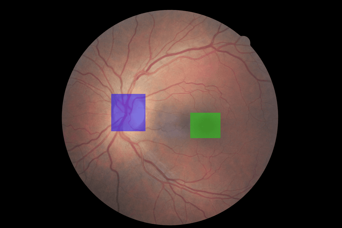 Optic Disc and Fovea detection